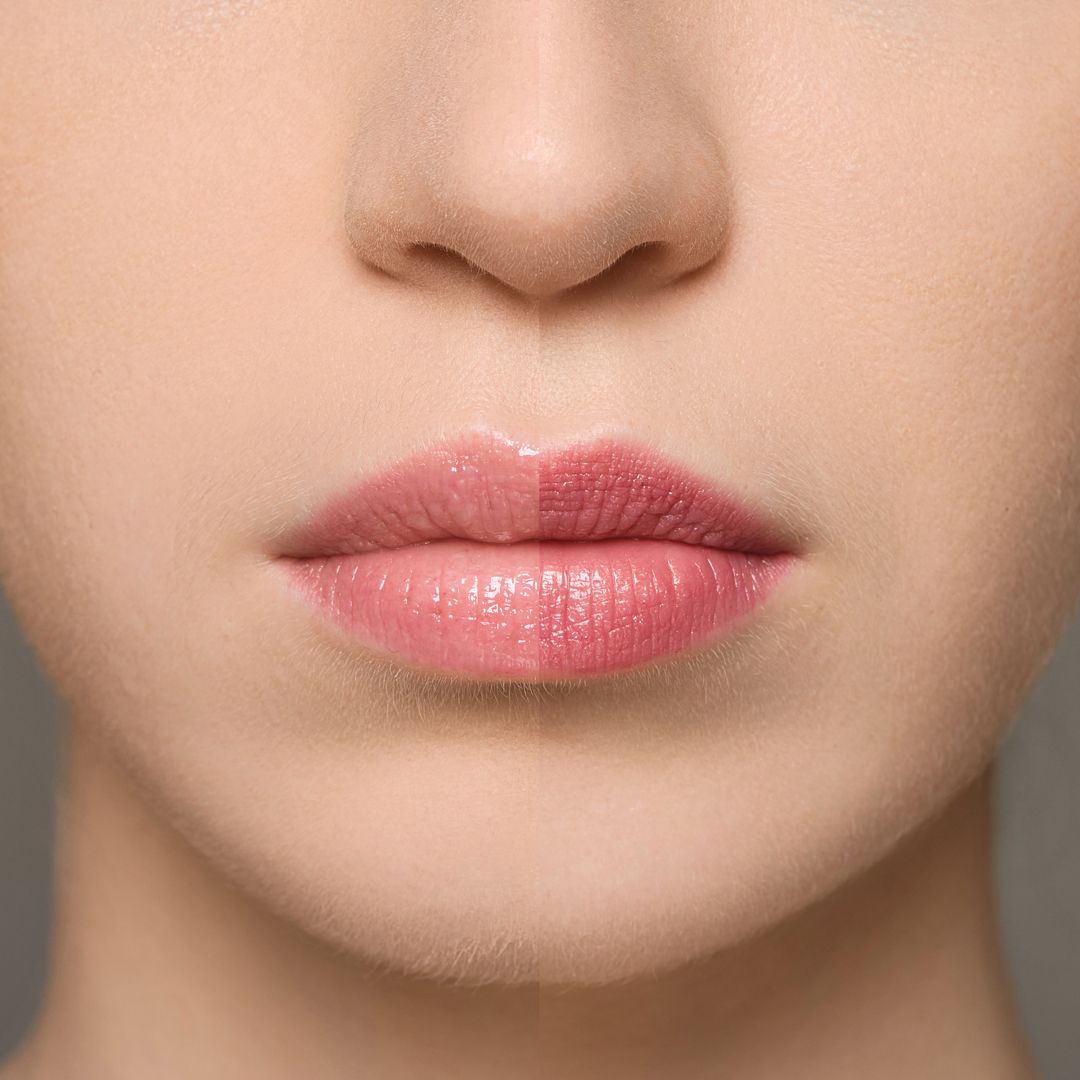 Baume à lèvres Moniamori Supreme Lip Treatment Fraise – soin vegan hydratant et réparateur aux arômes fruités.